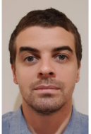 Frandjian Hugo, DMD, OMFS, Hôpital de la conception, Marseille, France